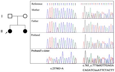 Novel compound heterozygous variants in EMC1 associated with global developmental delay: a lesson from a non-silent synonymous exonic mutation